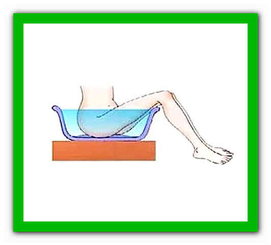 Ванночка при беременности. Сидячие ванночки лечебные. Сидячие ванночки в гинекологии. Сидячие ванночки после операции. Ванночка для гинекологических процедур.