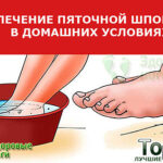 kak-vylechit-narodnymi-sredstvami-shporu-na-pyatke