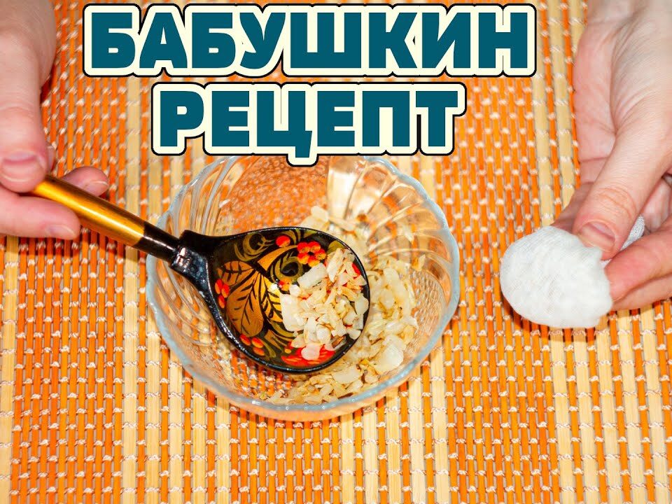 polipy-v-nosu-lechenie-narodnymi-sredstvami