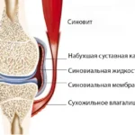sinovit-lechit-narodnymi-sredstvami