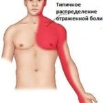 torakalgiya-lechenie-v-domashnix-usloviyax