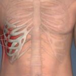 treshhina-rebra-simptomy-i-lechenie-v-domashnix