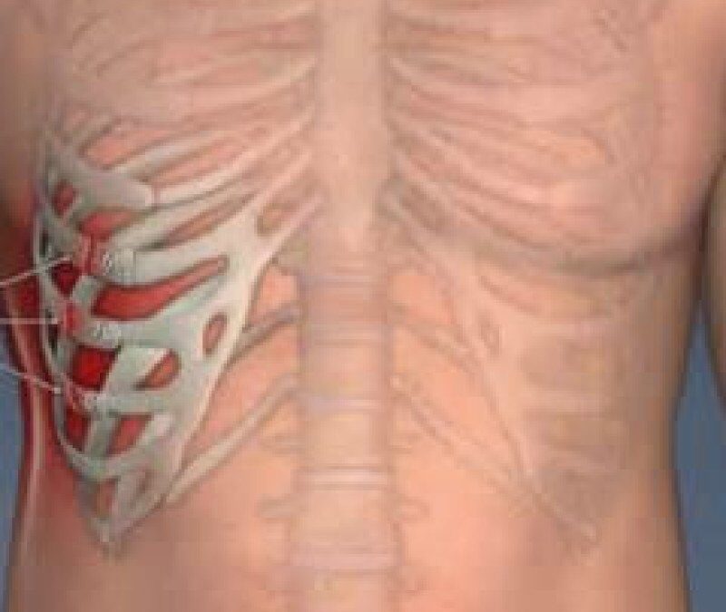 treshhina-rebra-simptomy-i-lechenie-v-domashnix