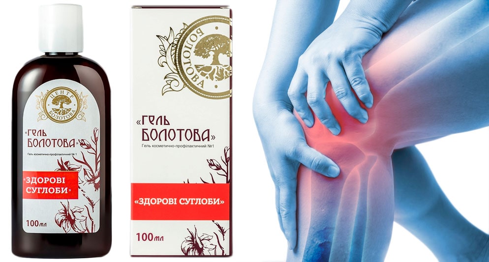 lechenie-bursita-kolennogo-sustava-narodnymi-sredstvami